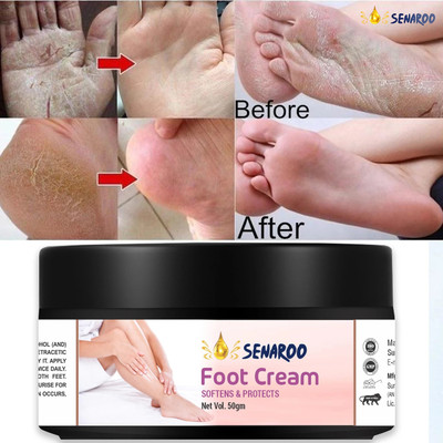 SENAROO Foot and Elbow Cream with Goodness of Turmeric and milk-50g(50 g)
