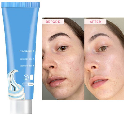 Libline FACE CLEANSING ICE CREAM MASK CLEAN POSE BLACK HEAD REMOVER MASK(120 ml)