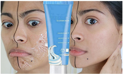 Libline Ice Cream Mask Clean Pores, Acid Ultra Cleansing Mask(120 ml)