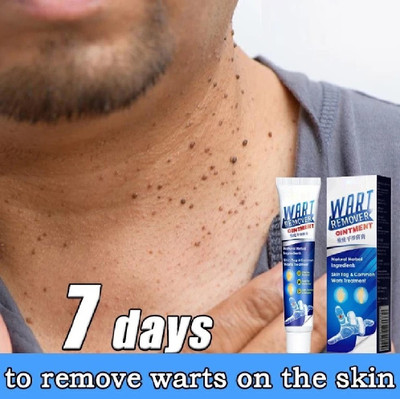 luzimaisa Fast Wart Skin Removal Ointment Gel For Women And Men(100 g)