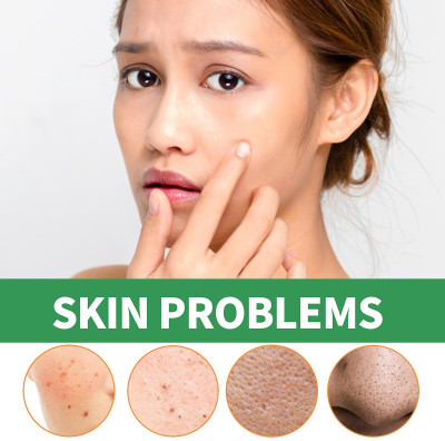 WOONGMI Green Mask stick Poreless Deep Cleanse Face Mask  Face Shaping Mask