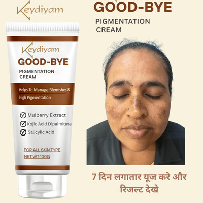 DRIDDLE Pigmentation removal cream for women Acne Scar Removal Dark Spots Stretch Marks(100 g)