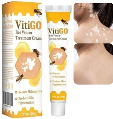 URBANUCANBE Vitigo Bee Venom Cream for Rash Prevention (100 g))(100 g)
