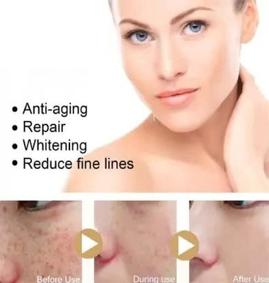 WOONGMI Oil Control Anti-Acne Deep Pore Cleansing Face Pack(80 g)