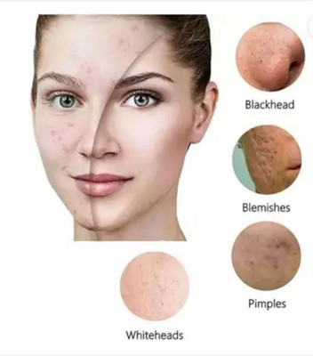 CATERINACHIARA Green Tea Mask Stick For Man & Woman Face Mask Masks /1/(40 g)