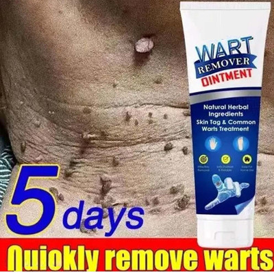 WOONGMI Wart remover ointment cream for Wart free skin Men & Women(100 g)