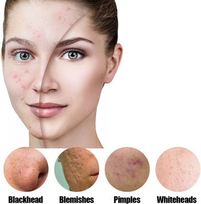 Wonholli Mud Mask Deep Cleaning Oil Control Moisturizing Hydrating Skin mask(40 g)