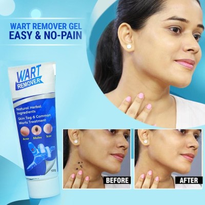 manasona Men & Women Skin Care Wart Removal Cream(100 g)