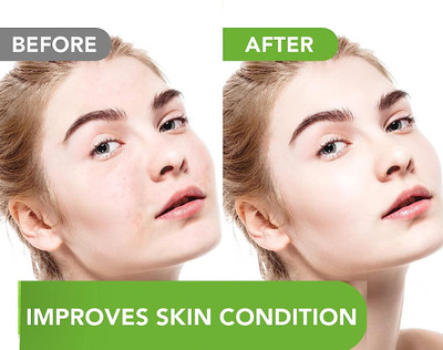 Libline Green Stick Mask Purifying Clay Face Oil Control AntiAcne Facial Detox Mud Mask(40 g)
