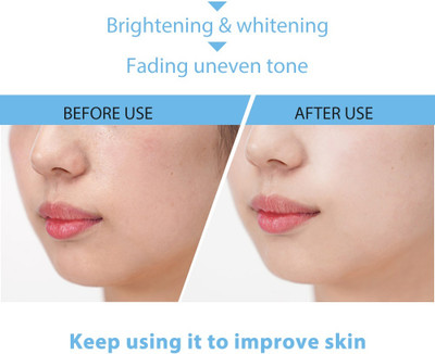 Wonholli FACE CLEANSING ICE CREAM MASK CLEAN POSE BLACK HEAD REMOVER MASK(120 ml)