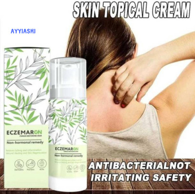 AYYIASHI Eczemaron Anti Fungal Advanced Formula Cream For Tough Fungal Issues(100 ml)