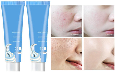 Libline Ice Cream Face Mask Acne Fades Moisturizing Smear Mask Blackheads Remover(240 ml)
