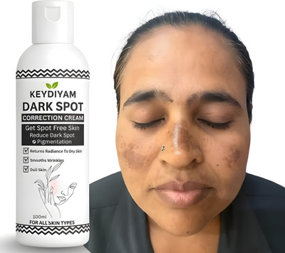 keydiyam DARK SPOT face cream(100 ml)