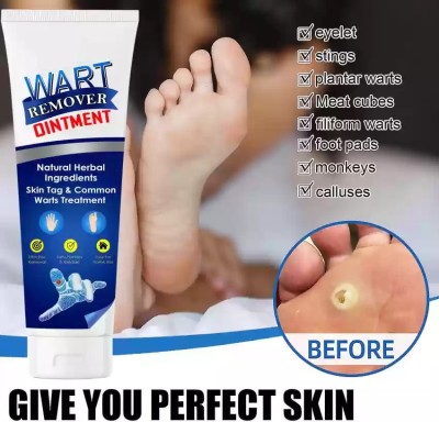 luzimaisa Massa And Wart Skin Removal Ointment Gel(100 g)