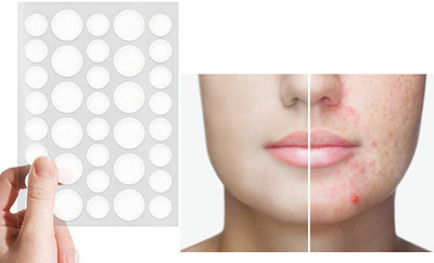 REIMICHI Rubber Blackhead Remover Strips(Pack of 36)