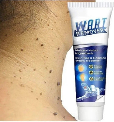 YAWI Best wart removal cream for private parts(100 g)