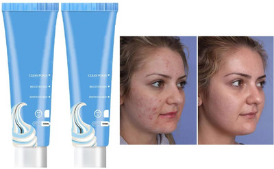 Luster Shine Ice Cream Mask Tube for Face Gel Hydrating Moisturizer(240 g)