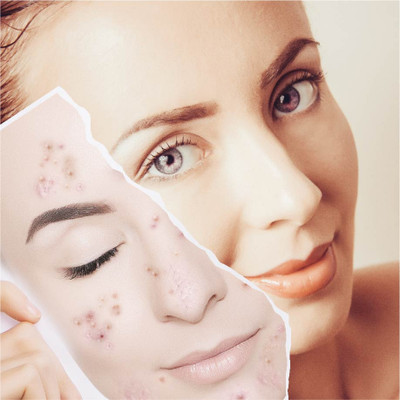 tanvi27 Sticks Face Shaping shining Mask  Face Shaping Mask