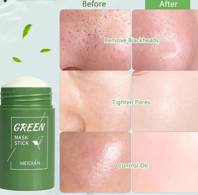 Humanix Stick Mask Origina Oil Control Anti Acne Face Shaping Mask Pack Of 1  Face Shaping Mask