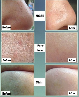 Emijun Mask Pore Detox Black Charcoal Clay Stick Face Mask Stick Face Wash(42 g)