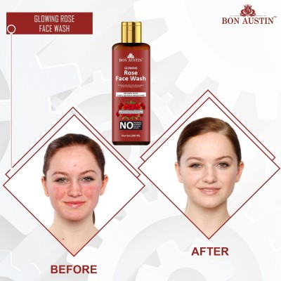 Bon Austin Rose |Facial Cleanser for both Men & Women Pack 1 of 200ML Face Wash(200 ml)