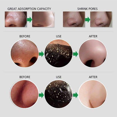 Yuency Charcoal Mask Peel Off Face Mask Cream & Stainless Steel Blackhead Remover Needle(2 Items in the set)