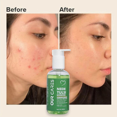 Ourcares Neem Tulsi  Gel: Clarify Your Complexion, Naturally Face Wash(200 ml)