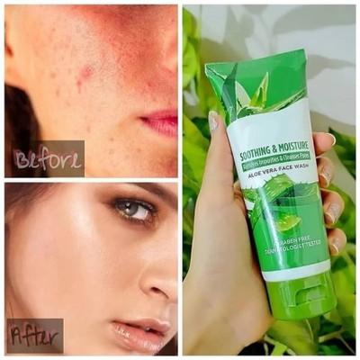 HUZURLU Aloe Vera  Purifies deeply and moisturizes the skin Face Wash(100 ml)