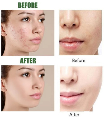 Wonholli Green Tea Extract, Deep Pore Cleansing, Moisturizing Mask Stick(40 g)
