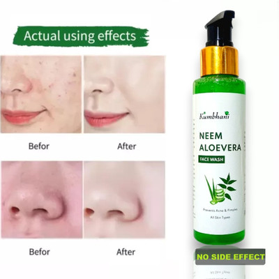 Kumbhani Neem and Aloevera with Neem, Ghrit Kumari and Tulsi Face Wash(100 ml)