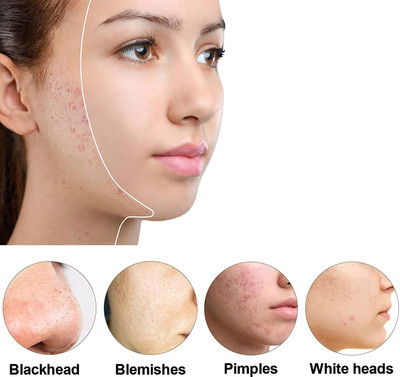 Wonholli Green Tea Deep Cleanse Mask Stick for Pore Cleansing(40 g)
