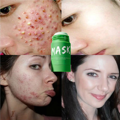AFARAXIA green Mask Stick Deep Cleaner, Oil Control Face Mask stick(40 g)