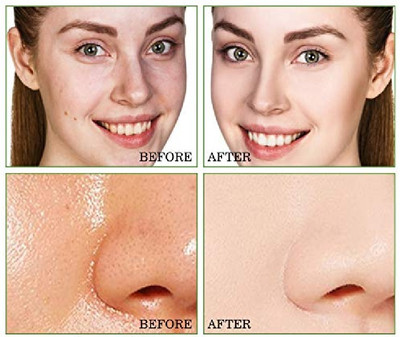Emijun oil control face care green stick mask for all type skin(40 g)
