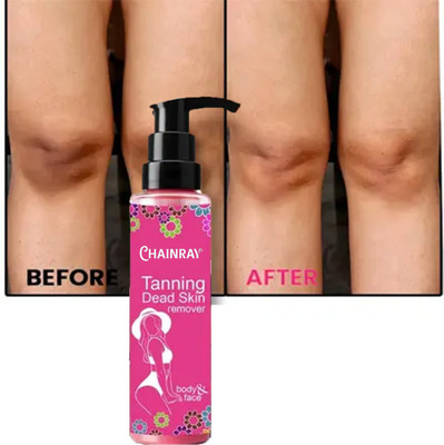 CHAINRAY Natural Care D Tan Face Pack |Tan removal(100 ml)