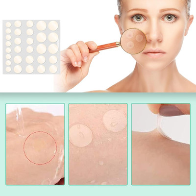 manasona 36 Pc Spot Clearing Acne pimple patch - Invisible Facial Stickers(5 g)