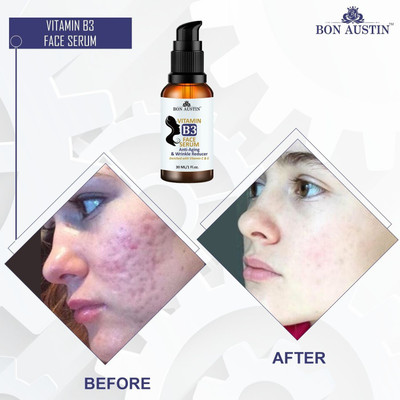 Bon Austin Premium Vitamin B3 Serum- For Skin Whitening & Brightening(30 ml)(30 ml)