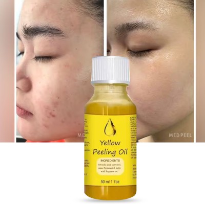 ODDEVEN Whitening Yellow Peeling Oil Extra Strength For Body(50 ml)