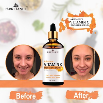 PARK DANIEL Vitamin C Booster Face Serum For Nourished & Bright Skin Pack of 1 30 ML(30 ml)
