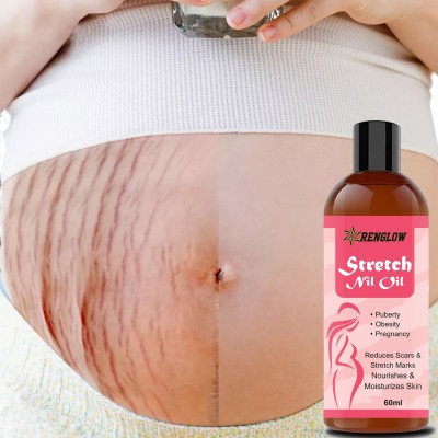 RENGLOW Pregnancy Stretch Mark Removal Oil Cream| Scar Removal | Anti Wrinkle(60 ml)