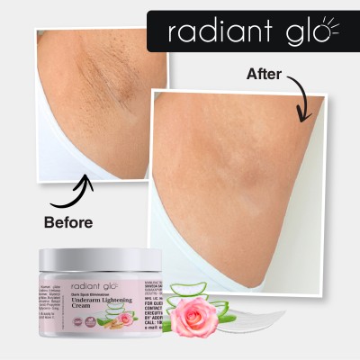 Radiant Glo Underarm Lightening Cream For Dark Spot Elimination | 50 g x 5(250 g)