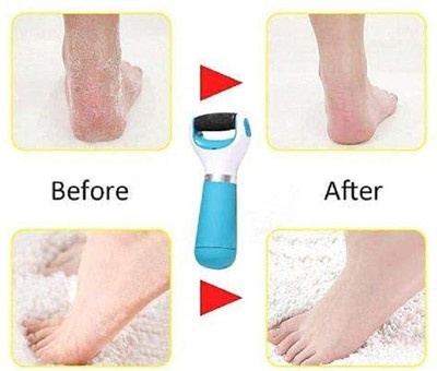 THTC Callus Remover for Feet,USB Rechargeable Electronic Foot File