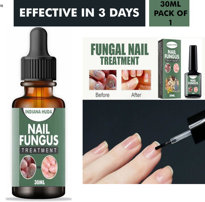 Buy TYA Nail fungus treatment solution, anti-fungal defense oil 30ml(30 ml)