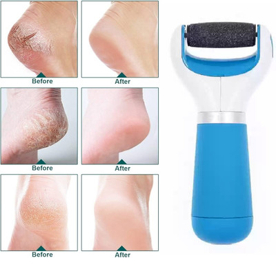 CATERINACHIARA BEST QUALITY FOR SOFT & SMOOTH FEET PEDI ROLLER