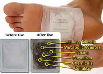 MAITRI ENTERPRISE Premium Quality Cleansing Detox Foot Patch Toxin Remover(2Pkt-20 Pads) M189
