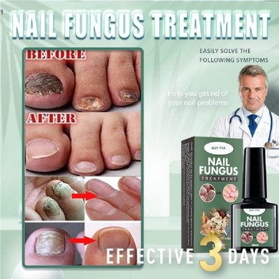 Buy TYA Nail fungus treatment solution, antifungal essential formula 30ml(30 ml)