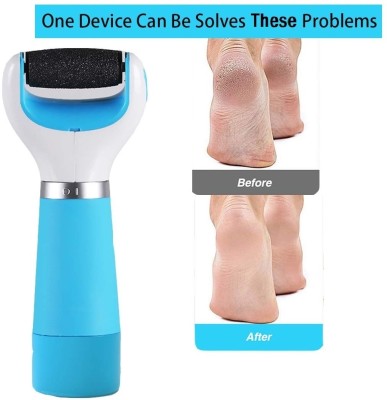 THTC Dead Skin Remover