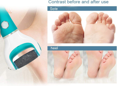 GABBU FOOT DEAD SKIN REMOVERS SOFT & EASY PEDI ROLLER