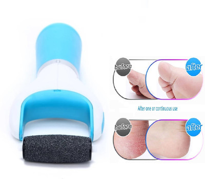 Neycare new best pediroller Dead Skin | Callus Remover | Electronic Smooth and Soft