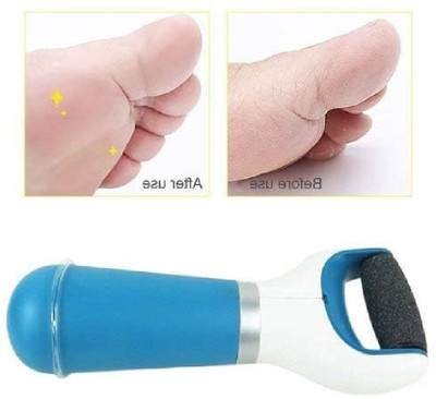 HUZURLU Callus Remover Rechargeable Pedicure Tool for Dead Skin