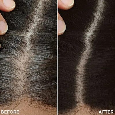 CATERINACHIARA Hair Fibers For Regrowth And Instant Styling Black Color/1// Hair Powder(25 ml)